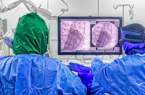 Success Rate of Laser Angioplasty