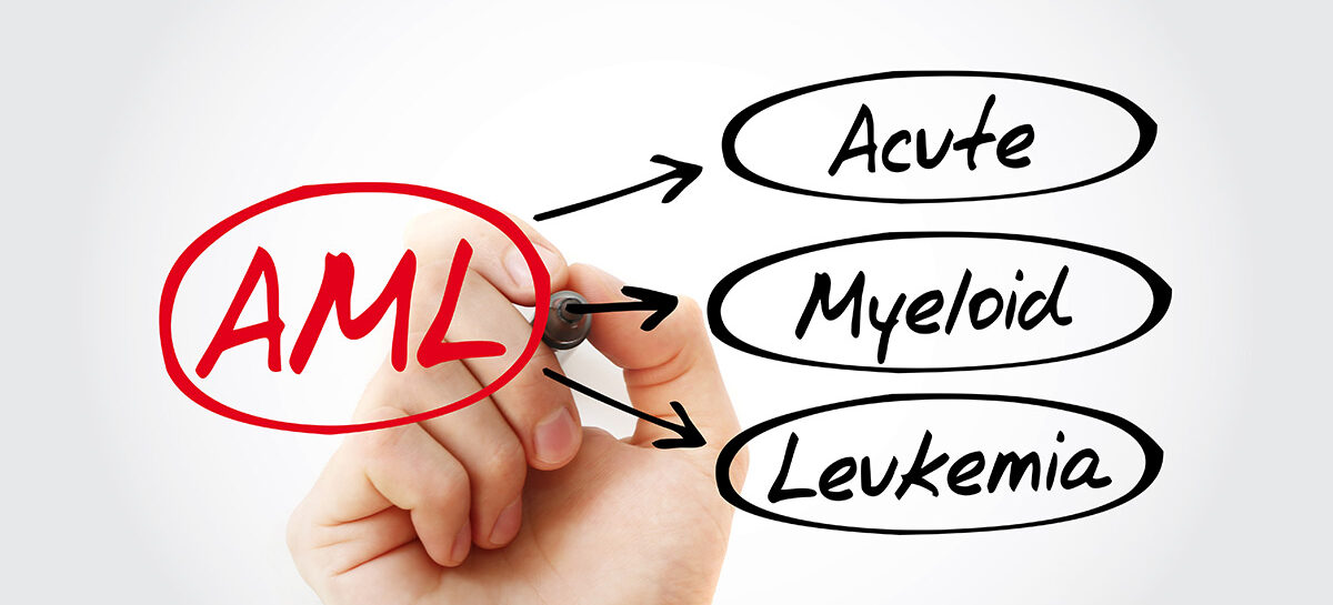 Causes, Symptoms and Treatment of Acute Myeloid Leukaemia