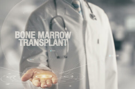 Graft-Versus-Host-Disease prevention after Bone Marrow Transplant