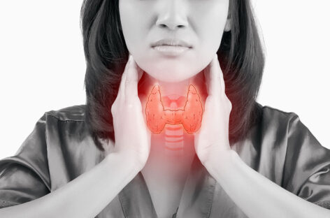 கழுத்தில் ஒரு பட்டாம்பூச்சி!