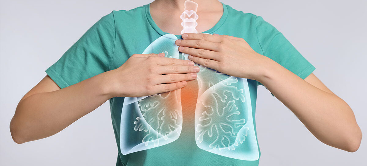 The 5 signs of Acute Respiratory Distress Syndrome