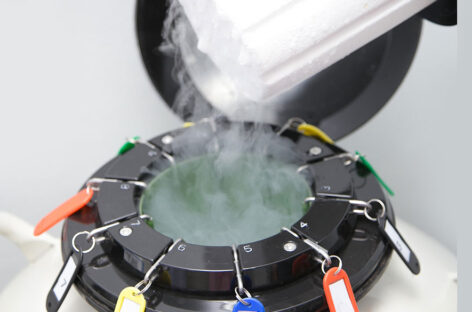 Egg Freezing – Your Key to Family Planning Freedom