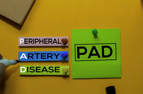 Invasive, Non-invasive and new-age treatments for Peripheral Artery Disease