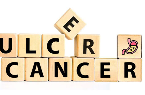Stomach Pain – Cancer or Ulcer?
