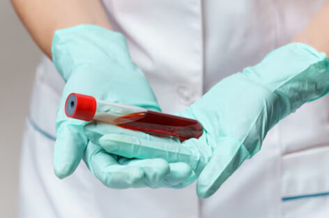 எலும்பு மஜ்ஜை மாற்று அறுவை சிகிச்சை என்றால் என்ன?