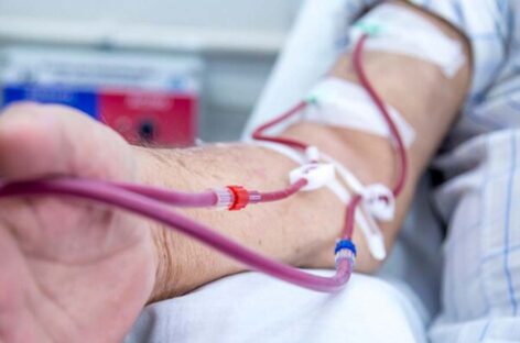 டயாலிசிஸ் ஏன்? எப்படி!