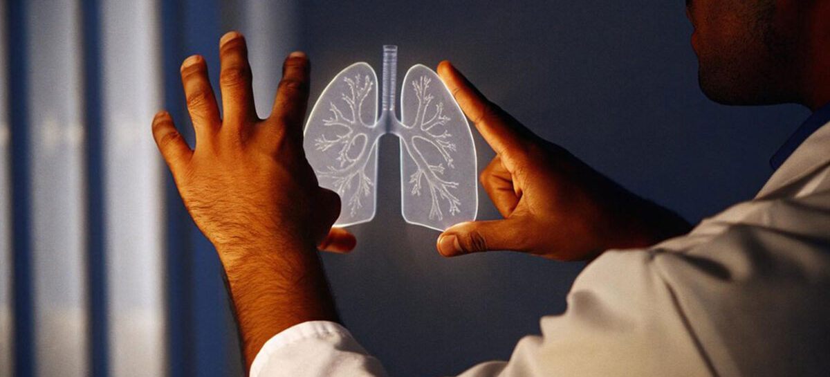 Bronchoscopic Cryotherapy