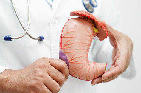 All About Gastric Polyps and Should You Be Worried if You Have Them
