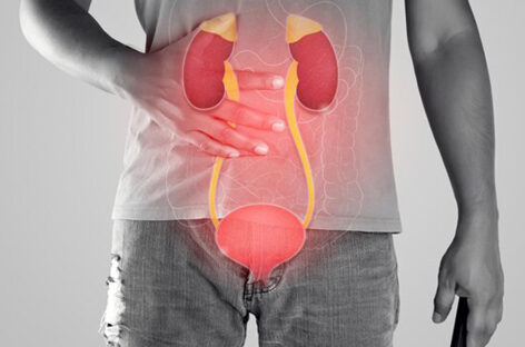All about Urethral Stricture Disease, Symptoms and Management