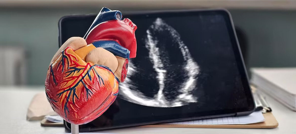 Coronary Artery Bypass Grafting: A Life-saving Heart Surgery