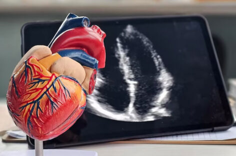 Coronary Artery Bypass Grafting: A Life-saving Heart Surgery