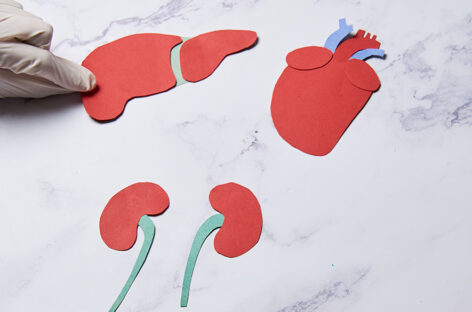 Living vs. Deceased Donor Transplants – Pros and Cons