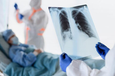 நிமோனியா A to Z