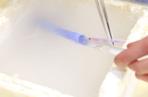 Preserving Fertility – Techniques for Future Family Planning