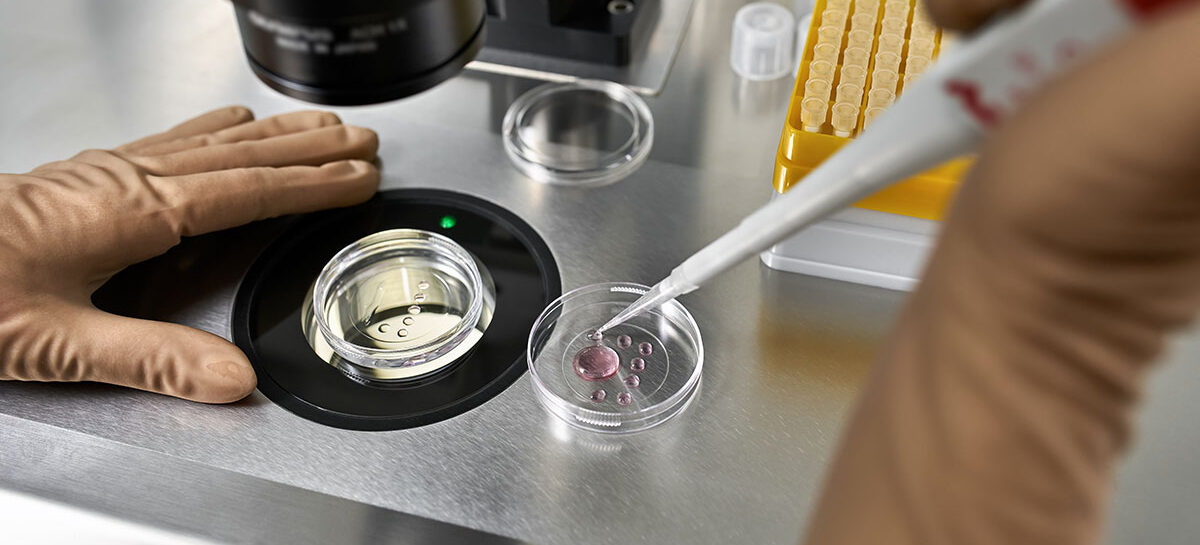 The IVF Process – A Comprehensive Step-by-Step Guide