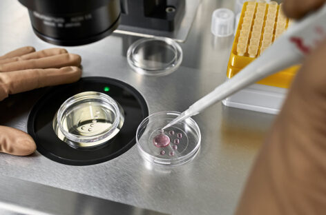 The IVF Process – A Comprehensive Step-by-Step Guide