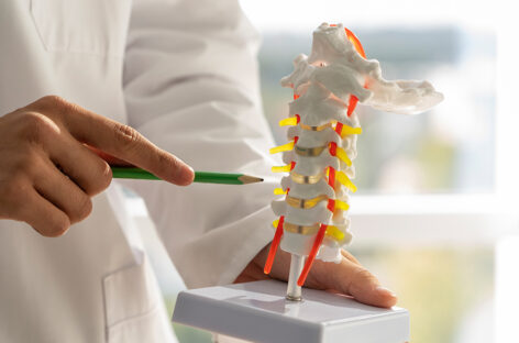 Vertebroplasty – Healing a Broken Spine