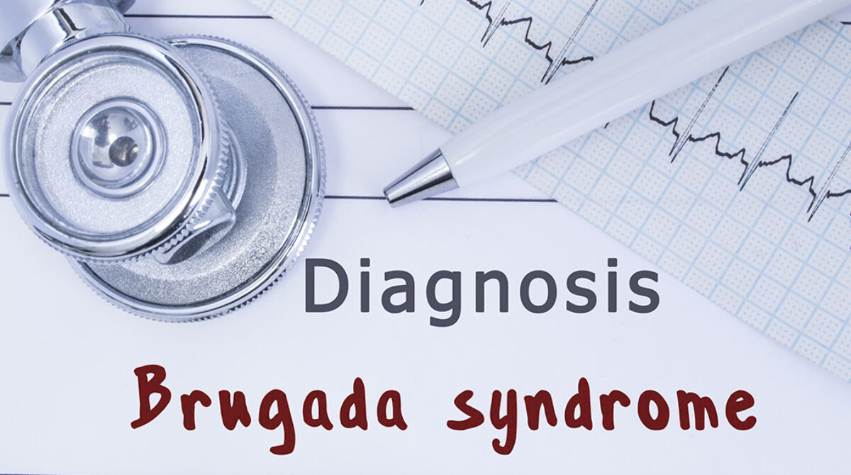 Brugada Syndrome – A Rare Genetic Heart Condition