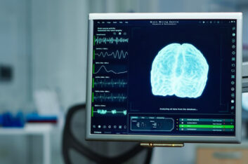 Encephalitis Explained