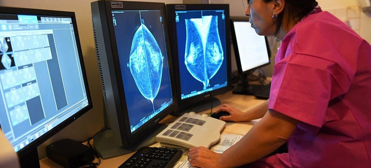 Top 5 Cancer Screenings Everyone Over 40 Should Consider