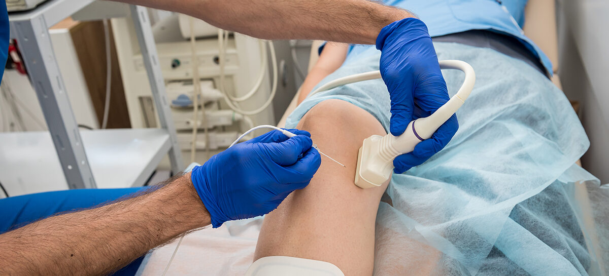 Radio Frequency Ablation of Osteoid Osteoma