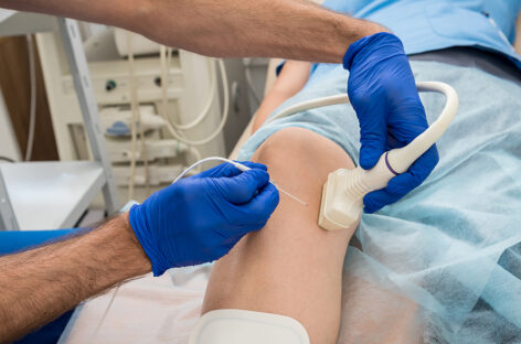 Radio Frequency Ablation of Osteoid Osteoma