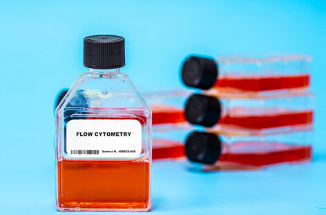Urinary Fluorescence Flow Cytometry