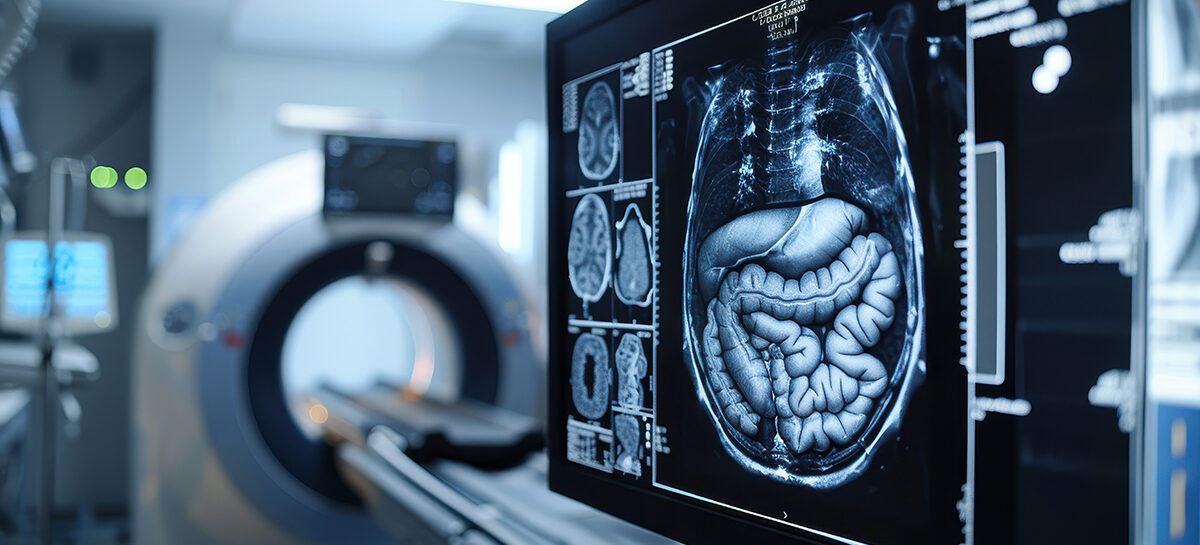 Interventional Radiology in the Treatment of Gastric Varices