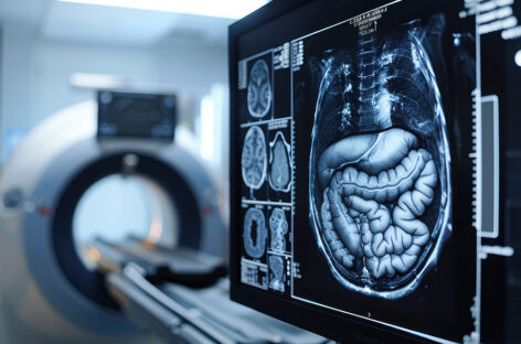 Interventional Radiology in the Treatment of Gastric Varices