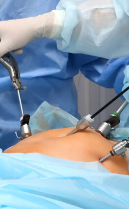A Big Leap Without the Big Cut: Laparoscopic Surgery, a Boon in Gastroenterology