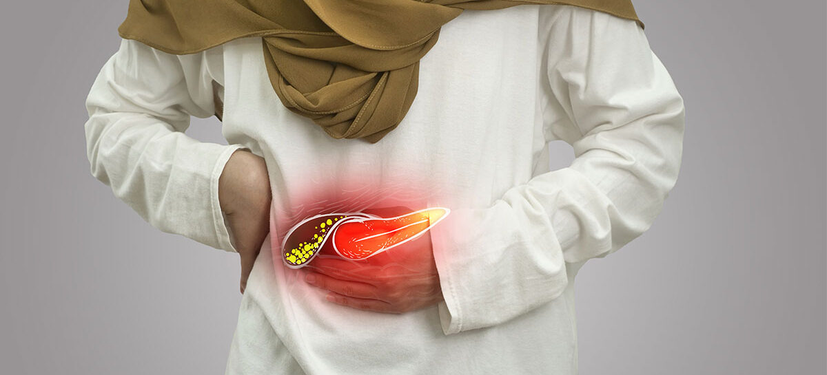 Gallstones Unveiled: All You Need to Know About this Silent Threat