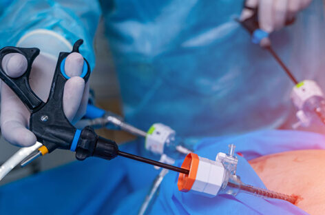 Spine Surgery Doesn’t Have to Be Scary Anymore