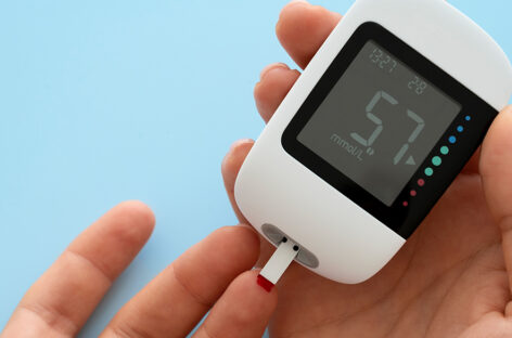 Dysglycaemia – Glucose irregularities and the subtle ways they affect your life