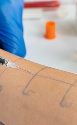 How can Allergy Testing help me?