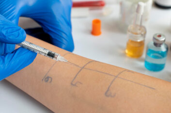 How can Allergy Testing help me?