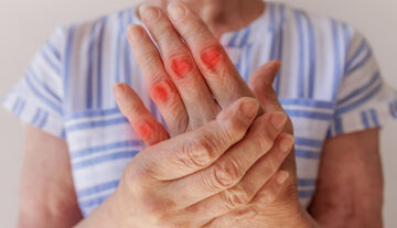 Tips to Manage Arthritis in your Hands