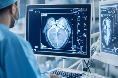 கார்டியாக் சி.டி ஸ்கேன் ‘மைனர் அட்டாக்’ ஆகும் முன் ‘மேஜர்’ எச்சரிக்கை!