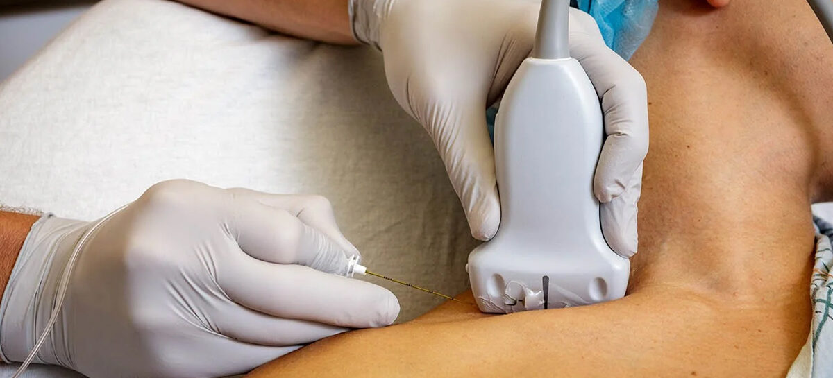 Regional Anaesthesia – A Way for Quick Recovery After Surgery