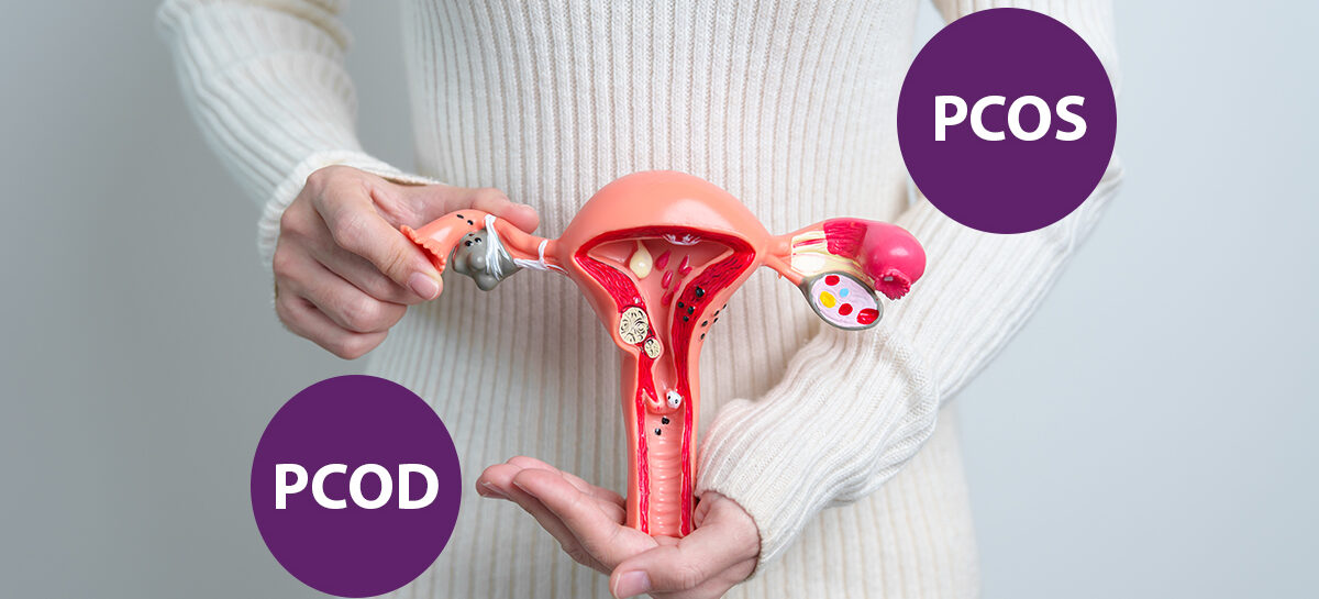 PCOD vs. PCOS-Key Differences