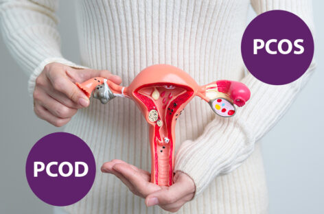PCOD vs. PCOS-Key Differences