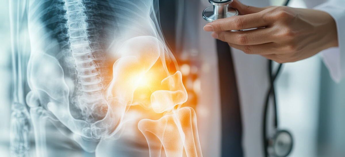 The Ultimate Guide to Bone Health