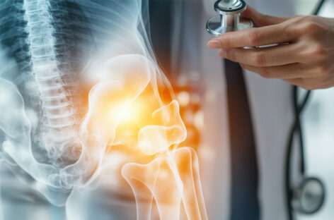 The Ultimate Guide to Bone Health