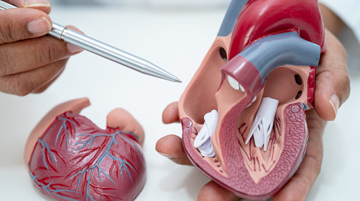 Why Choose Mitral Valve Repair Over Replacement?