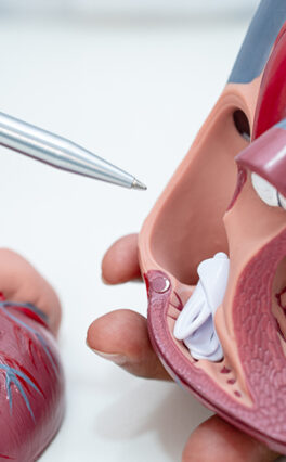 Why Choose Mitral Valve Repair Over Replacement?