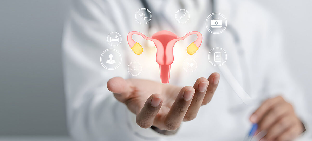 Most Common Dietary Mistakes in PCOS