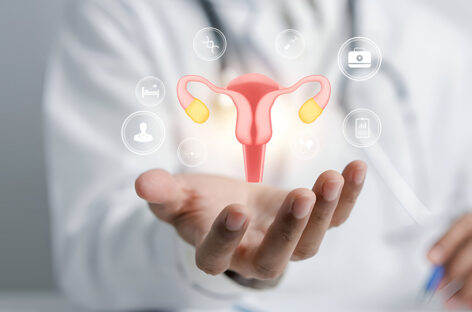 Most Common Dietary Mistakes in PCOS