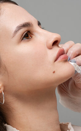 Everything you need to know about Botox