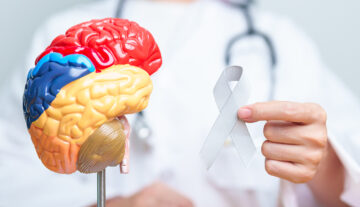 Brain Tumours Today: Earlier Detection, Safer Treatment and More Hope Than Ever Before