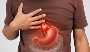 Hiatal Hernia