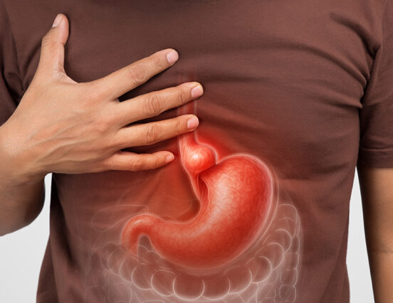 Hiatal Hernia